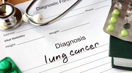 3 crucial tips for managing lung cancer