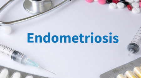 Endometriosis – Symptoms and natural remedies