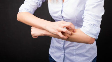 10 common early signs of prurigo nodularis