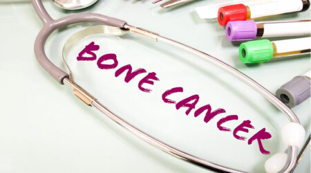 7 warning signs of bone cancer to be aware of
